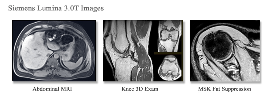 Siemens High-Field MRI